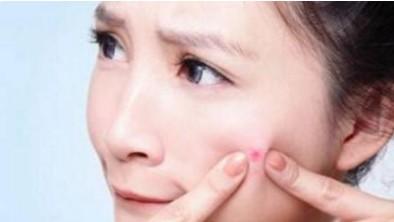 草莓鼻好不好（草莓鼻能好吗）