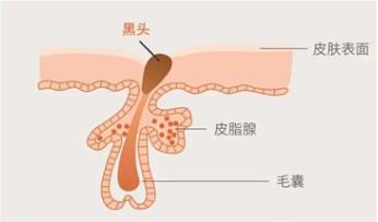 草莓鼻恐怖（草莓鼻的危害）